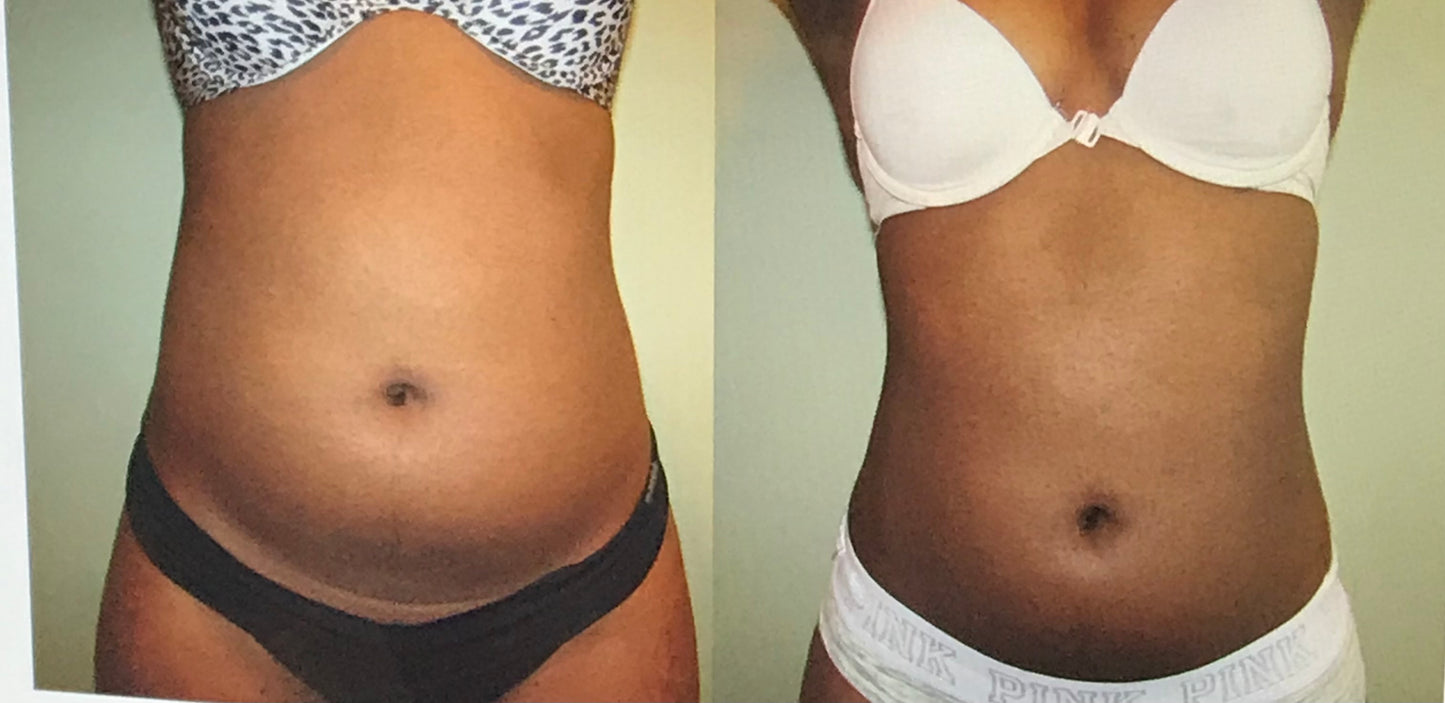 Belly Juiced