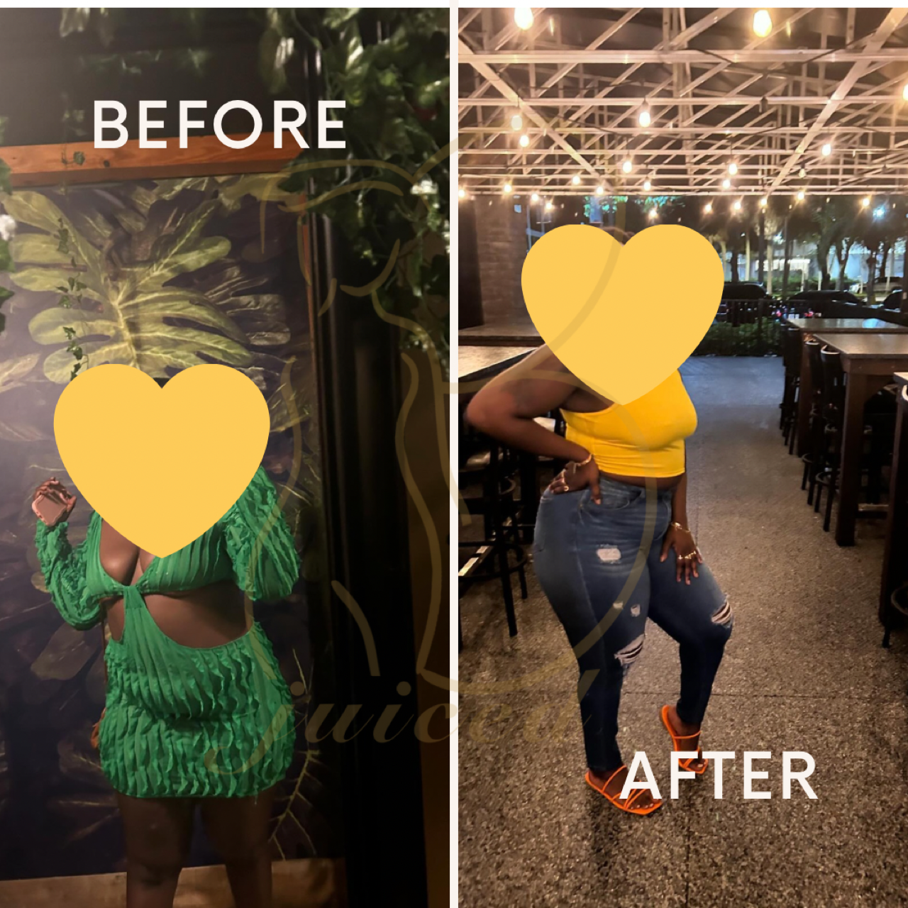 B-SLIM (Weight Loss Plan)